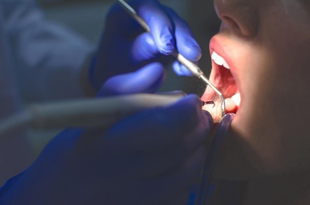 Featured image for “Misconceptions and Myths About Root Canals”