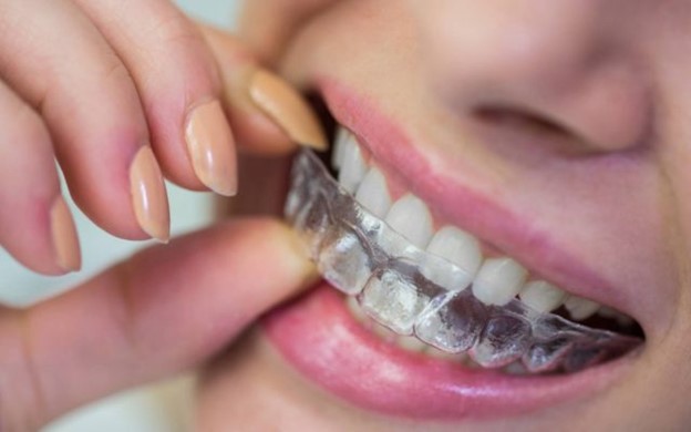 Featured image for “Night Guards Verses Athletic Guards – A Helpful Guide”