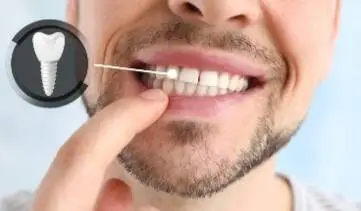 Close-up of a patient showing a dental implant replacement tooth