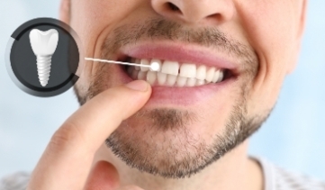 Close-up of a patient showing a dental implant replacement tooth