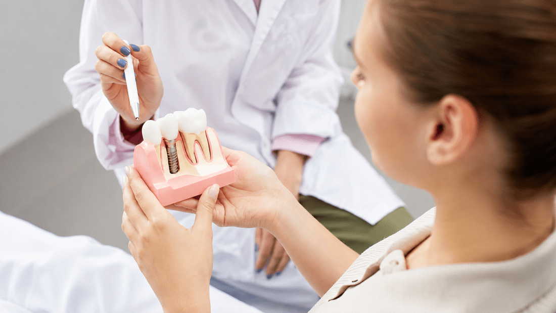 How Long Do Dental Implants Take?