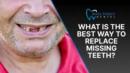What Is the Best Way to Replace Missing Teeth_