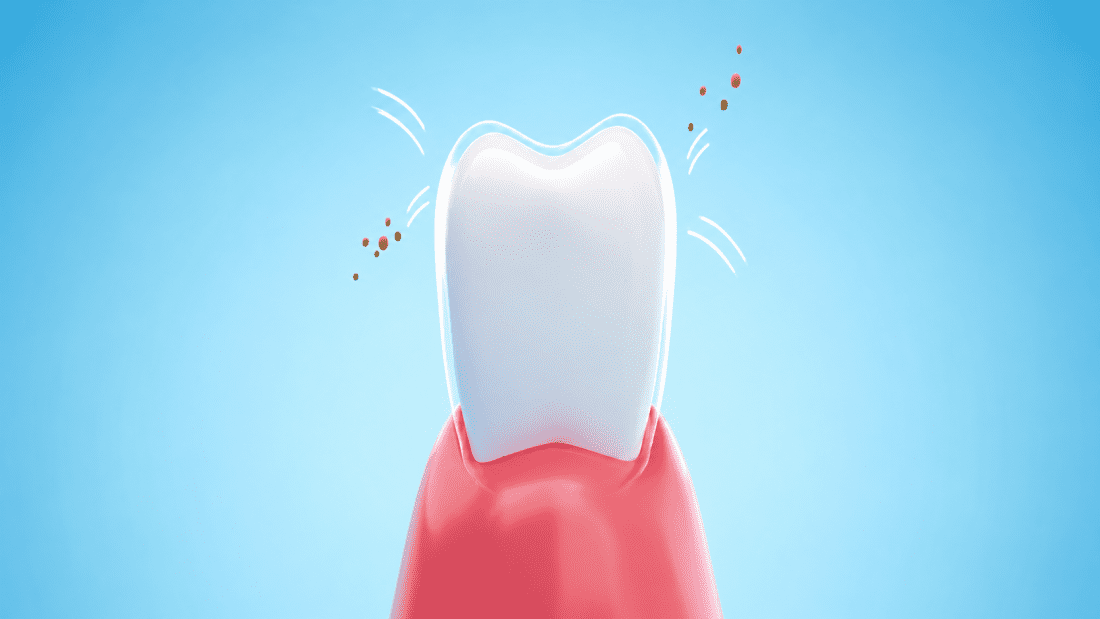 What Does Fluoride Do To Your Teeth?