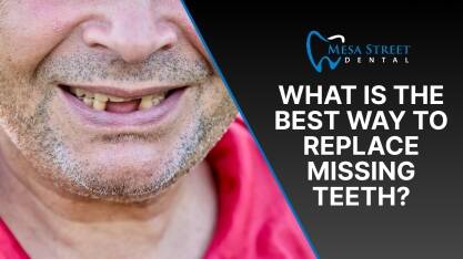 What Is the Best Way to Replace Missing Teeth_