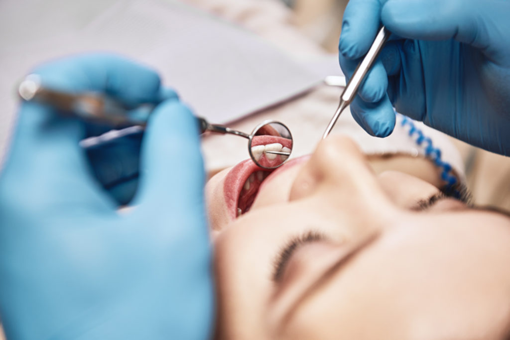 woman opening her mouth wide during inspectionwoman opening her mouth wide during inspection for dental inlays and onlays at the dentist's office