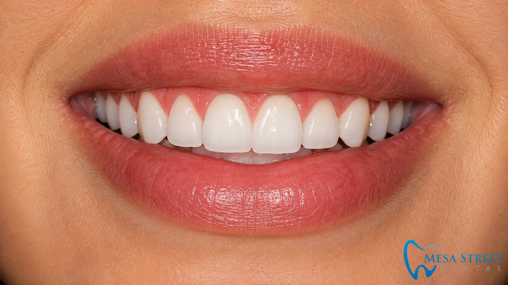Featured image for “Understanding Gum Recession: A Helpful Guide at Mesa Street Dental”