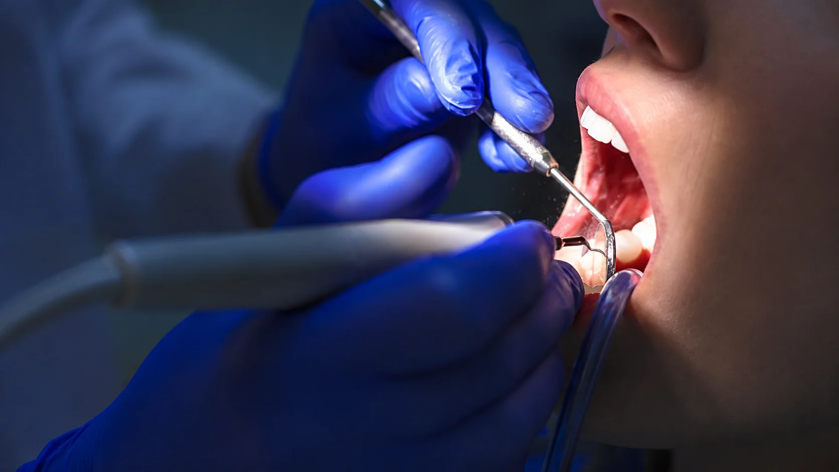 Featured image for “Misconceptions and Myths About Root Canals”