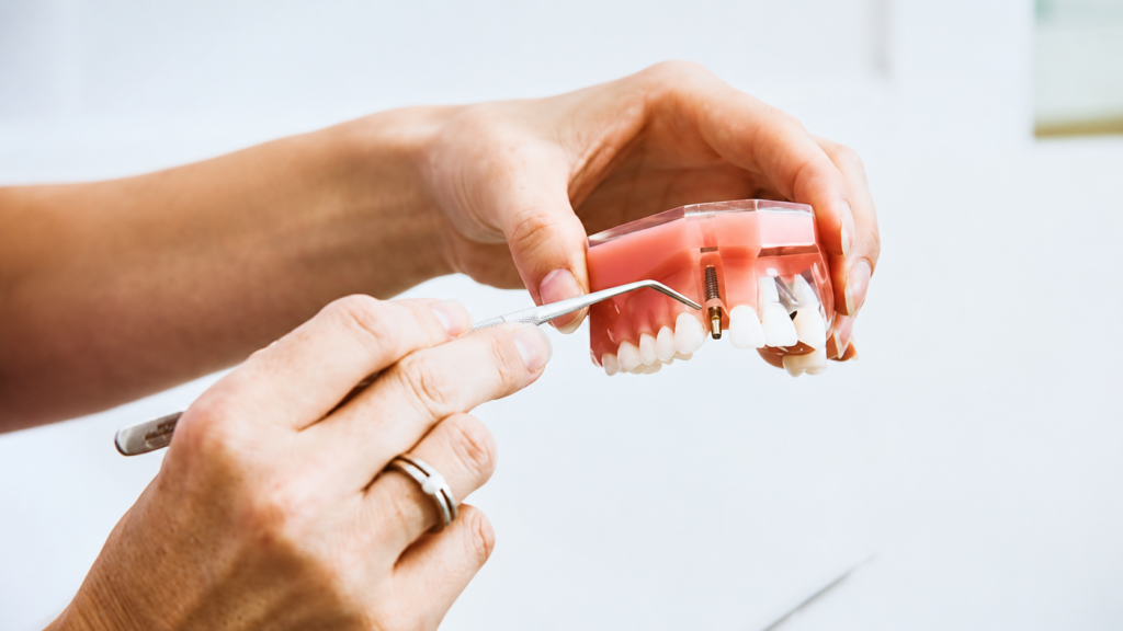 What Happens If You Don’t Brush Your Teeth?