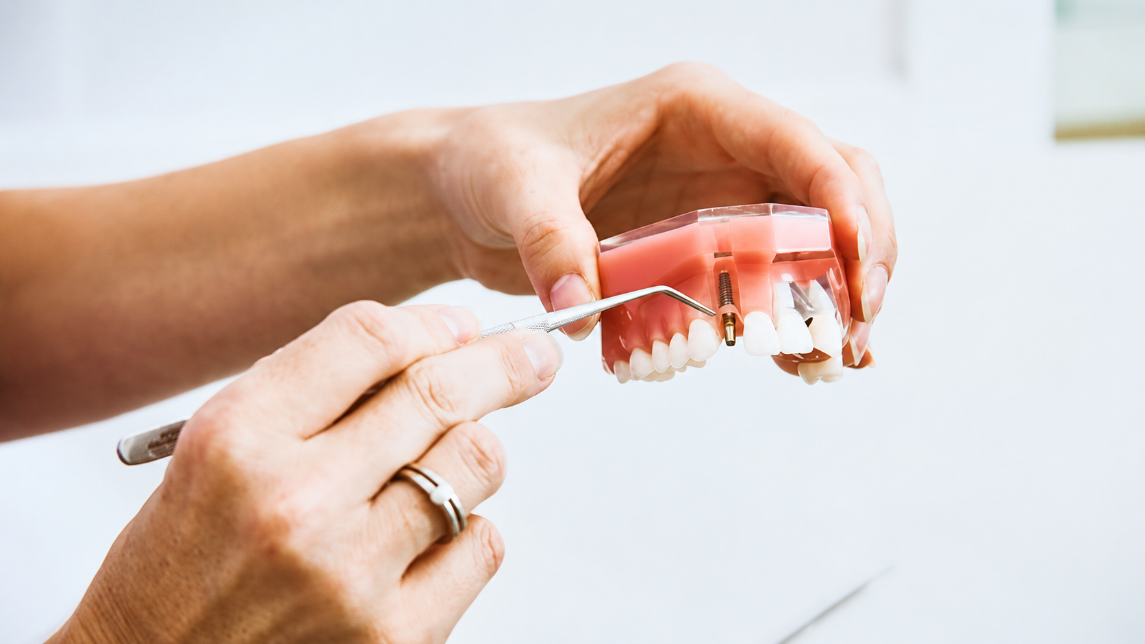 Featured image for “What Happens If You Don’t Brush Your Teeth?”