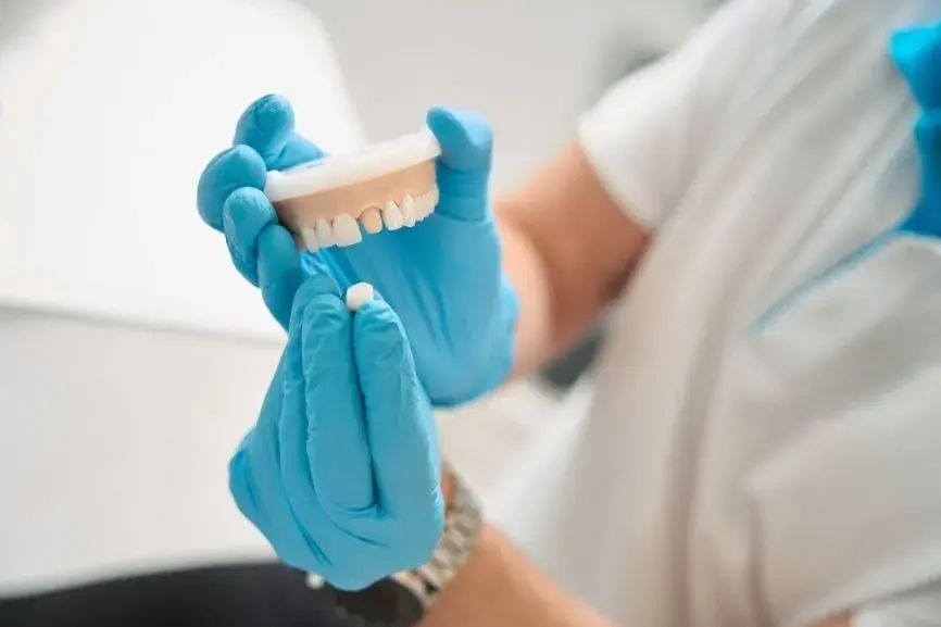 Featured image for “Front Tooth Dental Crowns: Everything You Need to Know”