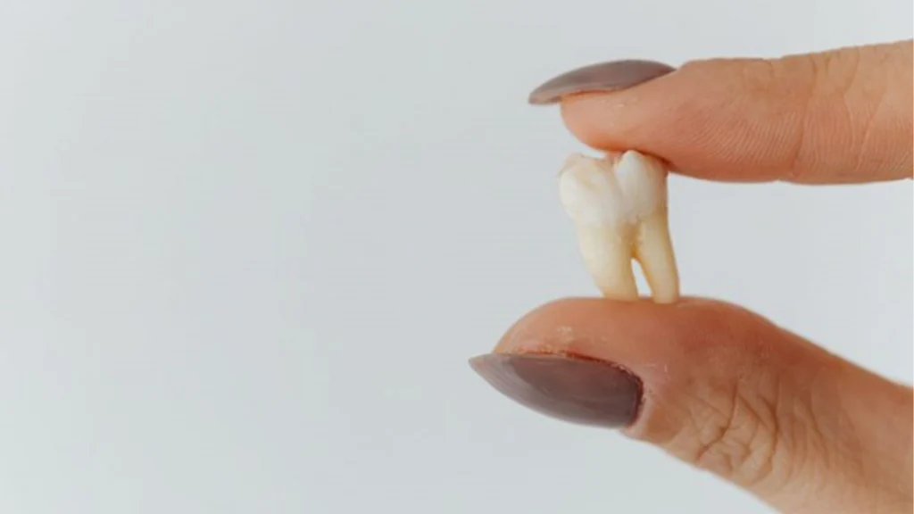 How to Fix a Chipped Tooth