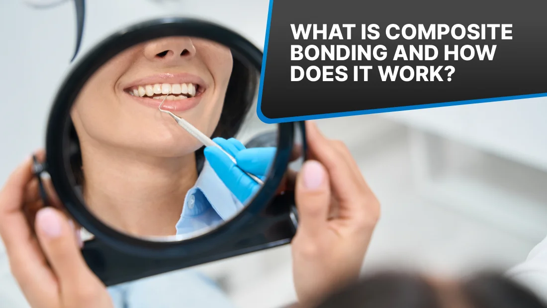 Featured image for “What Is Composite Bonding and How Does It Work?”