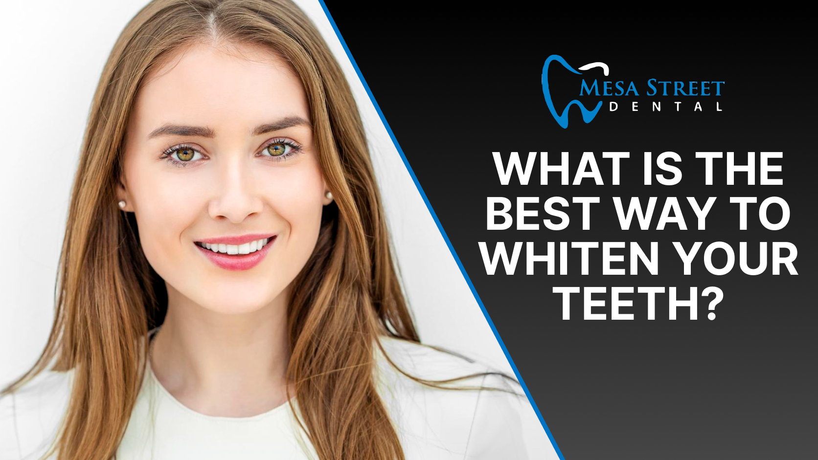 Featured image for “What Is the Best Way to Whiten Your Teeth?”